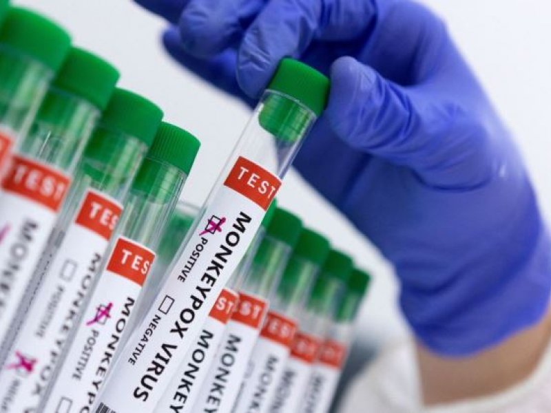 Imagem de Brasil faz 8.850 testes de varíola dos macacos