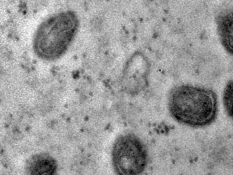 Imagem de Fiocruz registra imagens de replicação do vírus monkeypox em célula