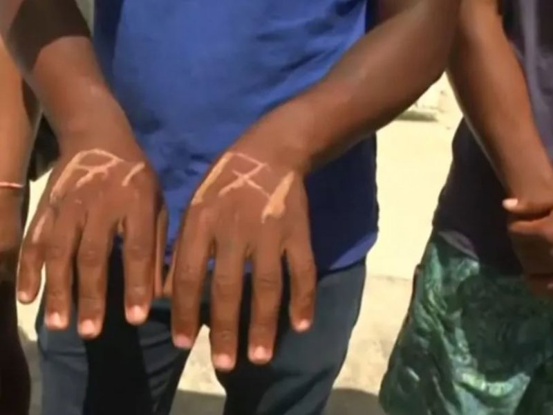 Imagem de Acusado de furto por ex-patrão relata tortura: "Queimou minhas mãos e me deu pauladas"