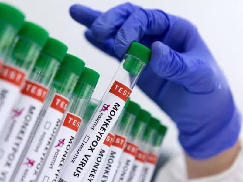 Imagem de Lacen confirma 29 casos de varíola dos macacos após início de testes