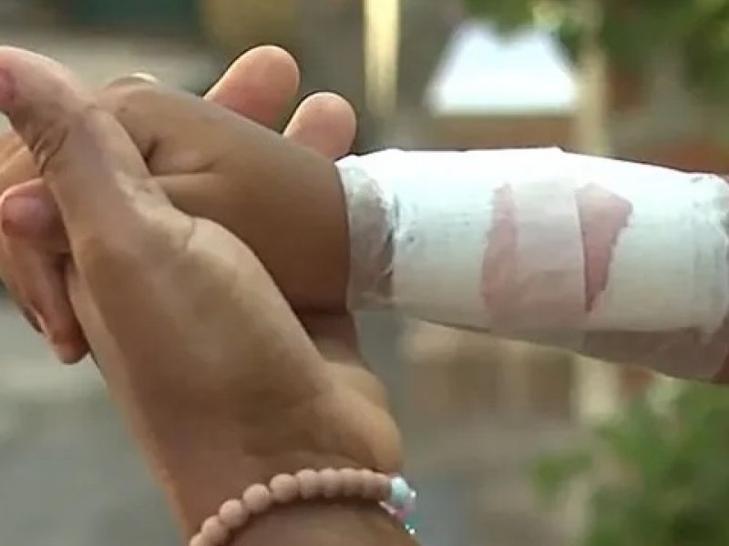 Imagem de Criança de 6 anos é baleada no braço durante ação policial em Tancredo Neves