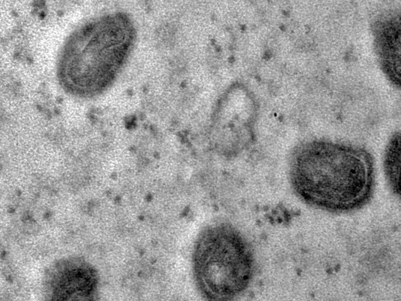 Imagem de OMS declara fim da emergência em saúde por mpox