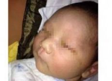 Imagem de Bebê fica cego após amigo da família fazer foto dele com flash