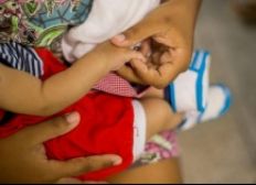 Imagem de Infecção por zika traz problemas a 1/3 dos bebês e em qualquer fase da gravidez