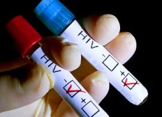 Imagem de Testes rápidos detectam 15 casos de HIV nos circuitos da folia