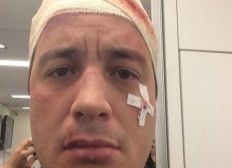 Imagem de Rafael Cortez se machucou durante gravação do CQC
