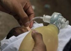 Imagem de Hospital da Índia registra 61 mortes de bebês em duas semanas