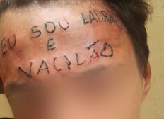 Imagem de Menor tatuado na testa passa pela 1ª sessão para remover frase ‘eu sou ladrão e vacilão’, diz clínica de reabilitação