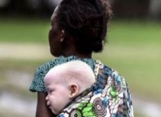 Imagem de Professor é preso ao tentar vender menina albina na África