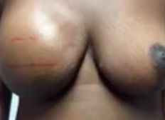 Imagem de Tatuador usa técnica que reproduz aréola e mamilo para mulheres que perderam mama por causa do câncer
