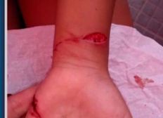 Imagem de Criança de 8 anos é atacada e mordida por capivara ao passar por margem de rio na Bahia