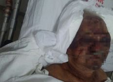 Imagem de Morre em hospital idoso de 80 anos agredido a pedradas durante assalto dentro de casa na Bahia