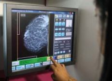 Imagem de Bahia realiza mais de 20 mil mamografias durante Outubro Rosa