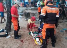 Imagem de Turista é atacado por tubarão em praia de Recife