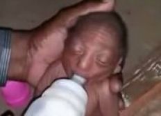 Imagem de Pais rejeitam bebê com doença rara por causa da aparência