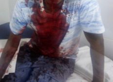 Imagem de Jovem sofre tentativa de homicídio em bairro periférico de Salvador