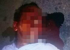 Imagem de Homem é morto durante tentativa de assalto no bairro de São Gonçalo