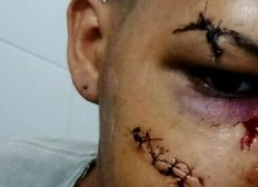 Imagem de Com rosto desfigurado, cabeleireiro denuncia agressão no norte da Bahia
