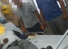 Imagem de Rodoviário é agredido com golpes de tesoura no Bairro da Paz