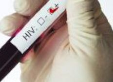 Imagem de Pesquisadores japoneses descobrem proteína inibidora do HIV em seres humanos