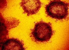 Imagem de Brasil tem primeira morte confirmada por coronavírus