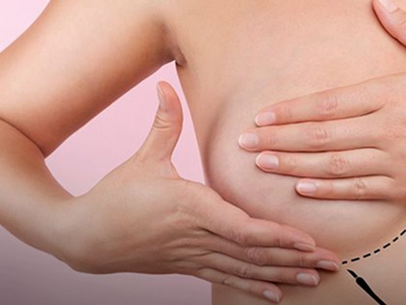 Imagem de Tratamento pode fazer câncer de mama regredir seis vezes mais rápido
