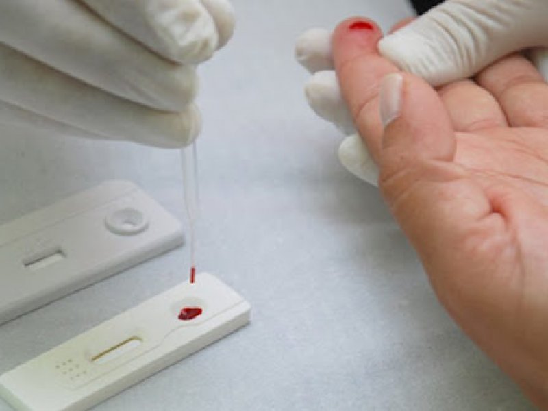 Imagem de Duas pessoas têm diagnósticos positivos após testagem rápida da Covid-19 na Boca do Rio