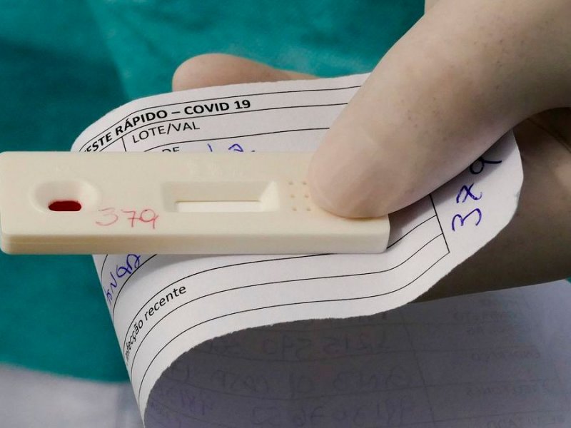 Imagem de Testes positivos de covid-19 são mais de 40% na Bahia e no Rio