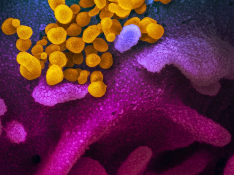 Imagem de Covid-19: estudo aponta aumento de bactérias resistentes em UTIs