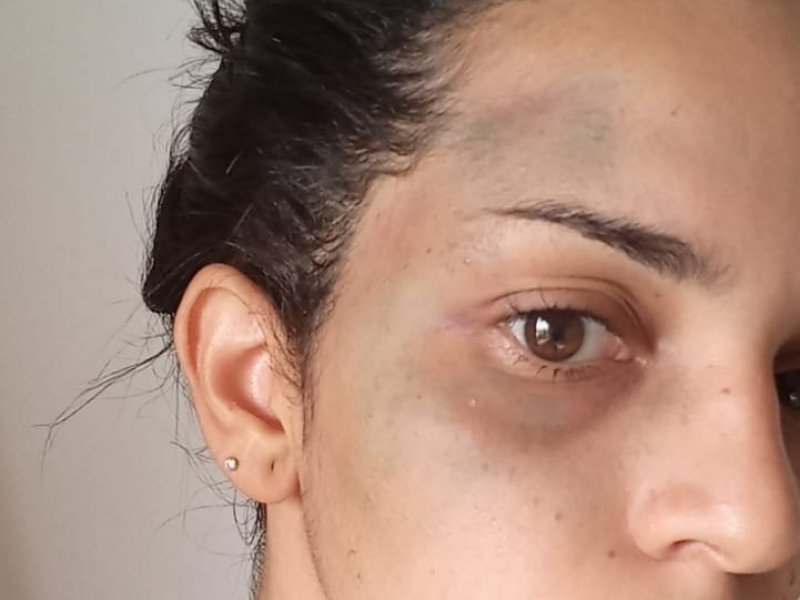 Imagem de Ex-funcionário e advogada caem em “emboscada” e são agredidos por dono da Amávia