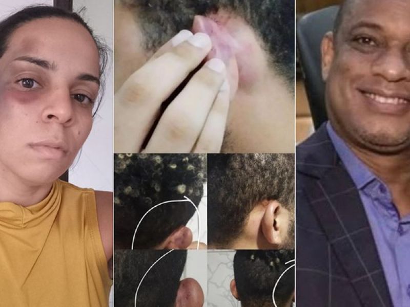 Imagem de Empresário nega agressão a advogada e ex-funcionário: ‘Fui a vítima’