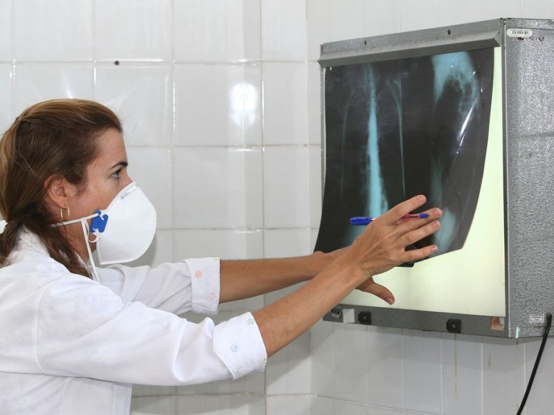 Imagem de Programa auxilia no combate e tratamento da tuberculose em Salvador