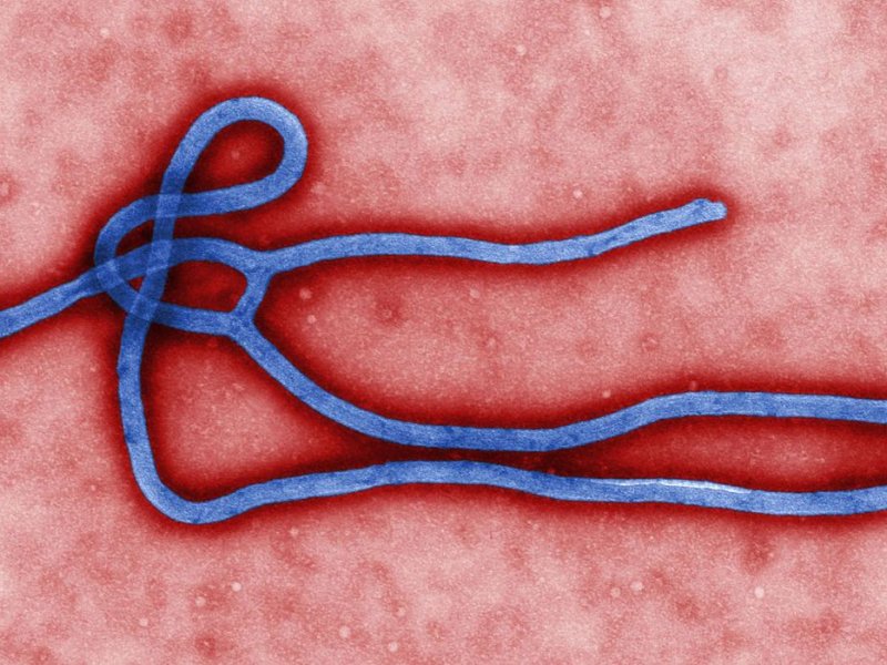 Imagem de Novo surto de ebola atinge a República Democrática do Congo