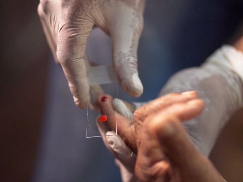 Imagem de Ministério da Saúde quer zerar casos de malária no país até 2035
