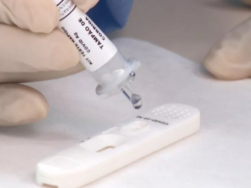 Imagem de Prefeitura realiza testes de Covid em alunos do Colégio São Paulo após estudantes positivarem