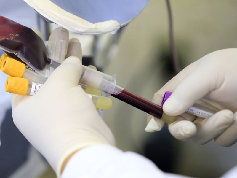 Imagem de Varíola dos macacos: Anvisa faz recomendações sobre doação de sangue