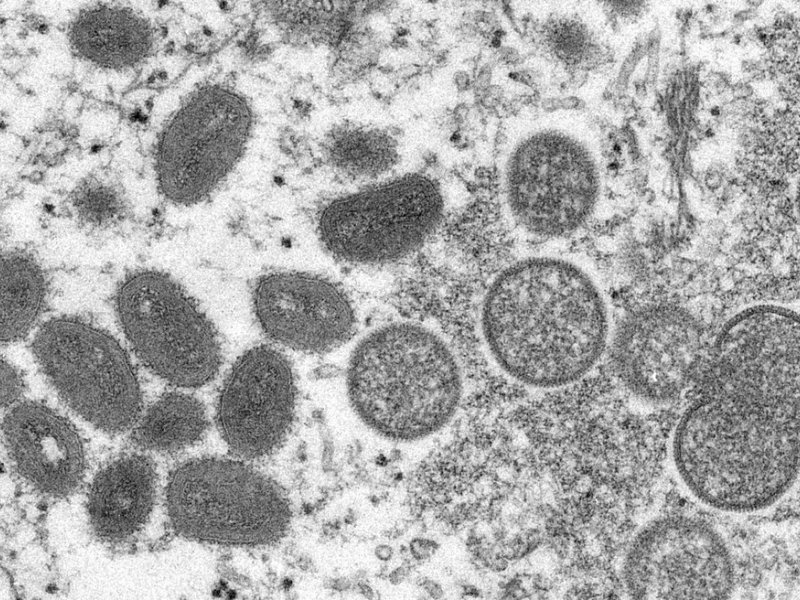 Imagem de Bahia confirma três primeiros casos de varíola dos macacos no interior